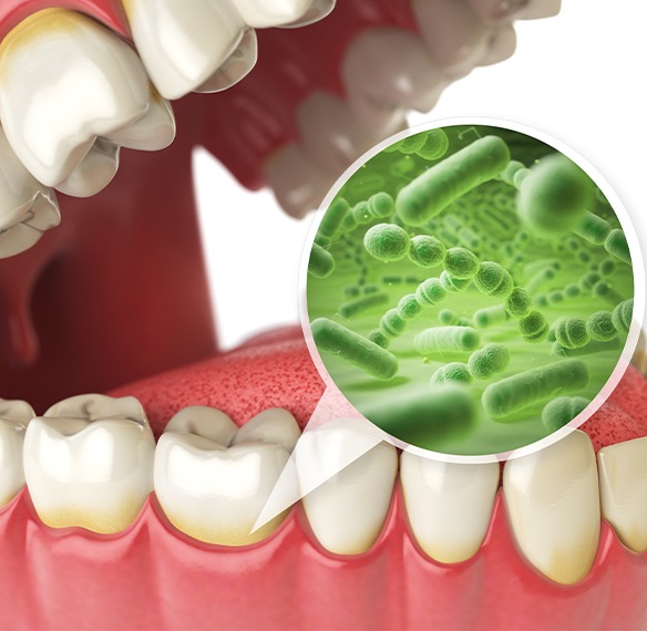 Animated smile with closeup of bacteria