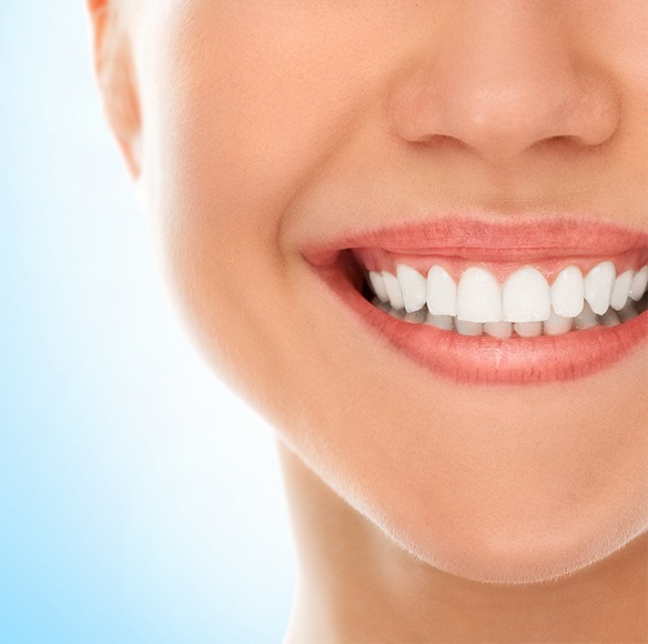 Flawless smile after professional teeth whitening
