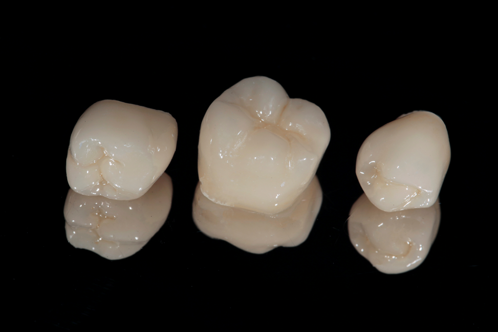 series of all ceramic dental crowns against black background